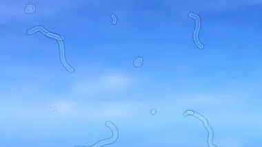 Я&nbsp;бачу &laquo;прозорих червячків&raquo;