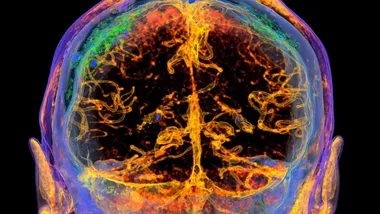 Фото Vsevolod Zviryk, Science Photo Library