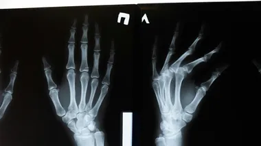 Фото cottonbro studio