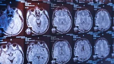 Ілюстративне зображення Pixel-shot/Alamy