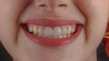 Зображення ZME Science