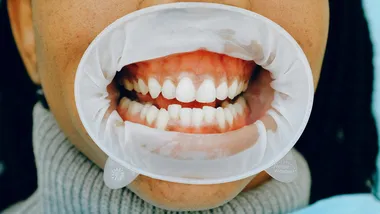 Фото Anna Shvets