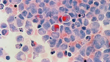 Фото National Cancer Institute