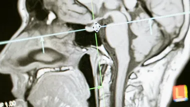 Ілюстративне зображення Pexels