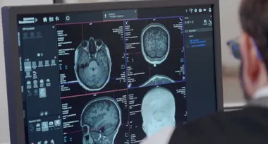 Дослідження алкоголізму: чому наука отримує менше фінансування